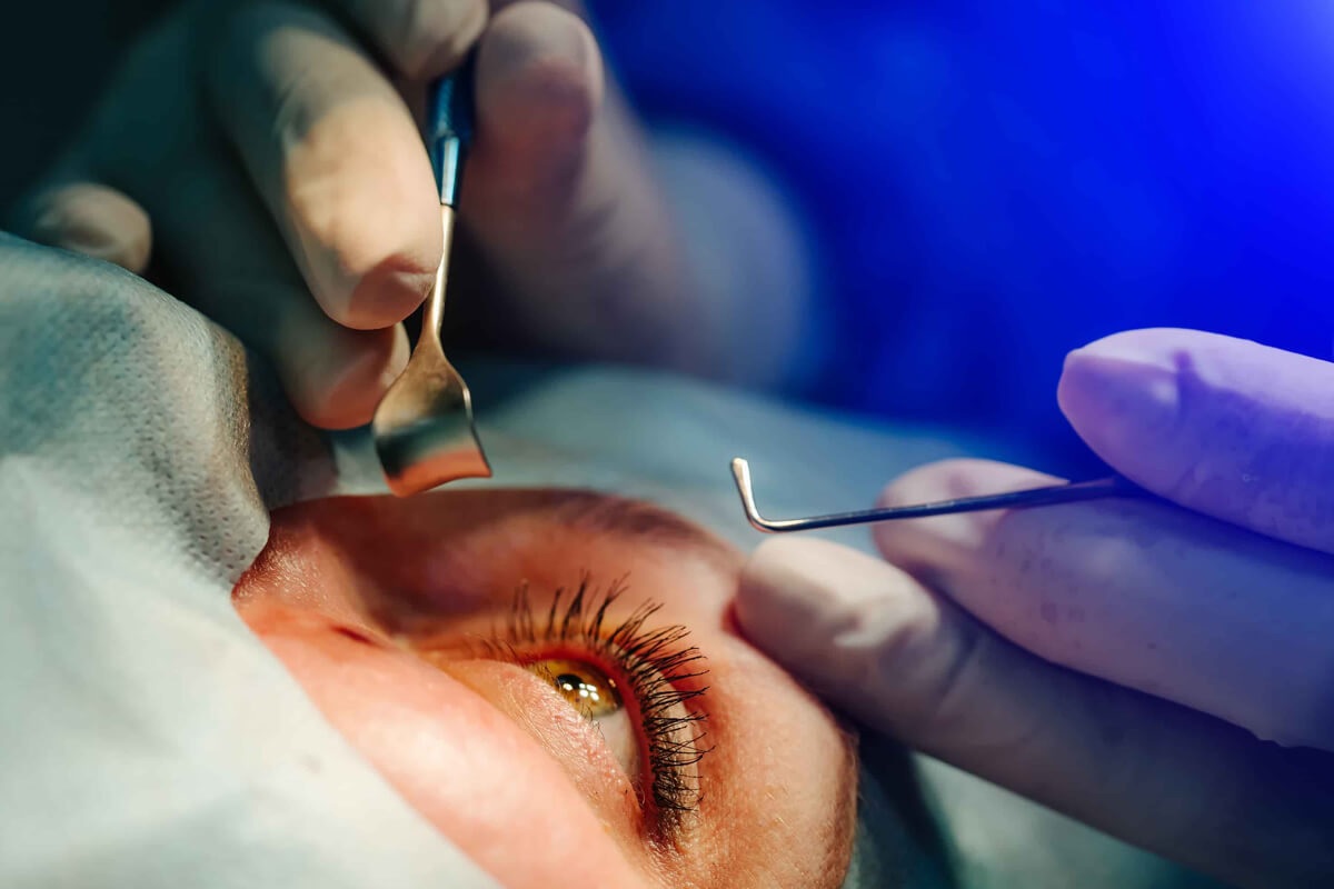 GÖZ CERRAHİSİNDE YENİ DÖNEM